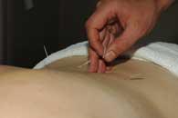 Acupuncture Bodywork image 7