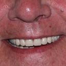 Birches Head Denture Clinic image 6