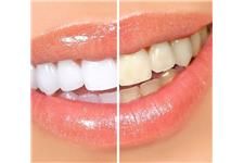 NW1 Dental Care image 1