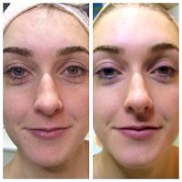 BeauSynergy Advanced Skin and Beauty Clinic image 5