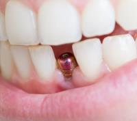 Zenith Dental Clinic  image 4