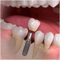 Zenith Dental Clinic  image 5