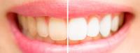 Zenith Dental Clinic  image 1