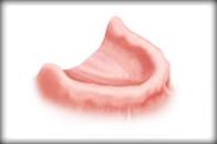 Dental Implants India image 2