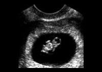 Baby Scan image 3