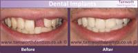 Ascent Dental Care Tamworth image 2