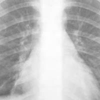 Children’s Respiratory Doctor image 18