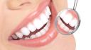 Dental Implants Expert logo