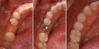 Dental Implants Expert image 3