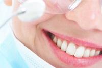 Dental Implants Expert image 5