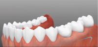  Dental Implant Clinic image 3