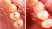 Fernleigh Dental Practice image 2