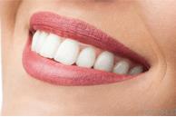 Teeth Whitening Thame image 2