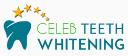 Teeth Whitening Walsall logo