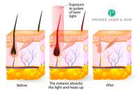 Premier Laser & Skin Clinic image 3