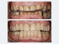 Norfolk Dental Specialists image 7