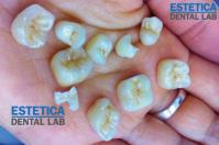 Estetica Dental Lab image 5