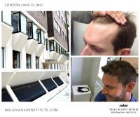 Malkani Hair Restoration Institute image 8