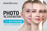 Clear Skin Clinic image 3