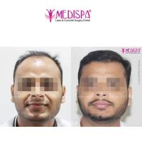 Medispa Hair Transplant Center image 2