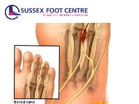 Sussex Foot Centre image 1