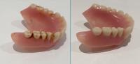 Advanced Denture Solutions  image 4