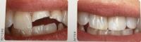Clent Dental Care image 1