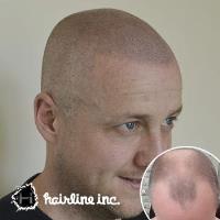 Hairline Inc Chester image 3