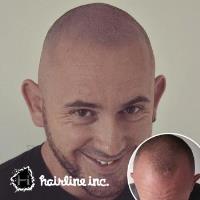 Hairline Inc Chester image 4