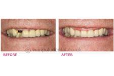 Wimpole Dental image 2