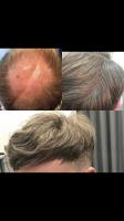 D.W Hair Hair Aesthetics image 5