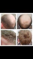 D.W Hair Hair Aesthetics image 6