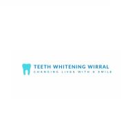Teeth Whitening Wirral image 1