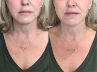 FacePerfect Clinic image 1