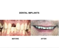 Dental Perfection Coventry image 3