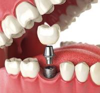 Broseley Dental Practice Ltd image 7