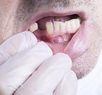 Broseley Dental Practice Ltd image 9