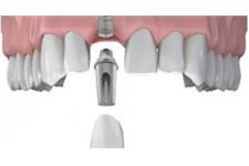 Cheshire Dental Solutions  image 3