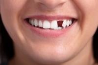 Instant Dental image 4