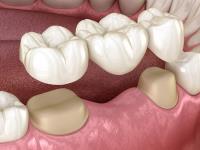 Instant Dental image 2