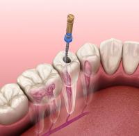 Instant Dental image 5