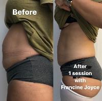  Francine Joyce - Cellulite Treatment image 1