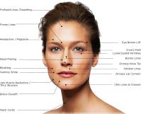 Botox and dermal filler training image 2