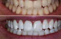 Love Teeth Dental image 3