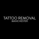 Tattoo Removal Manchester logo