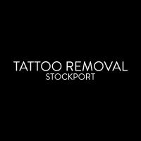 TATTOO REMOVAL STOCKPORT image 1