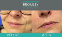 Bromley Aesthetics Ltd image 5
