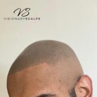 Visionary Scalps image 6