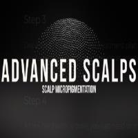 Advanced Scalps image 3
