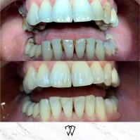 Wisdom Dental image 17